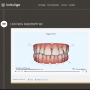 Nova publicao na Global Invisalign Gallery